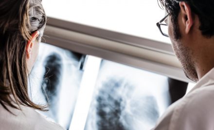 What to Do After a Lung Cancer Diagnosis: Steps, Changes, and Sharing with Loved Ones