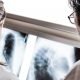 What to Do After a Lung Cancer Diagnosis: Steps, Changes, and Sharing with Loved Ones