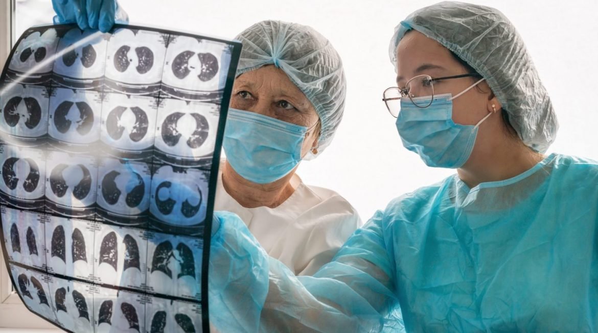 Lung Cancer Surgery: A Comprehensive Guide for Patients